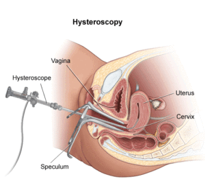 ivf Gurgaon