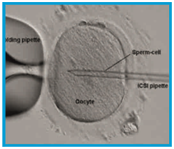 fertility clinic in gurgaon, infertility specialist in Gurgaon